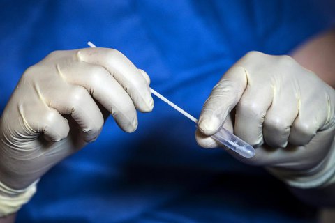 За добу в Україні 5 529 людей захворіли на ковід, 11 946 – одужали