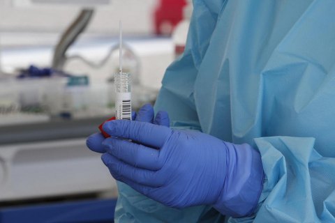 В Україні за добу – 479 випадків ковіду, госпіталізували 544 людини