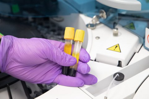 В Україні зафіксовано 617 нових випадків ковіду, померли 23 людини